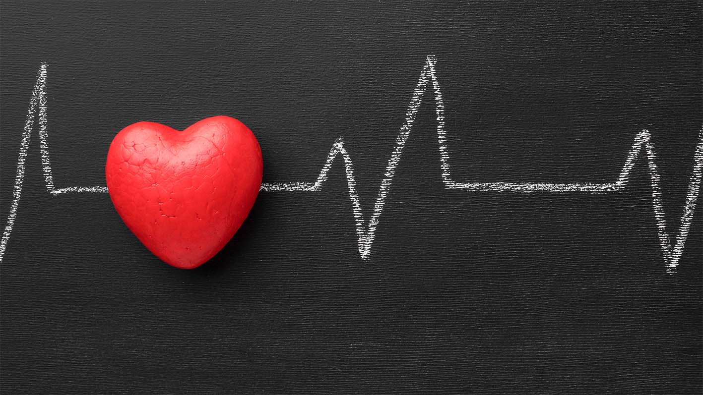 What You Need to Know About Irregular Heartbeats