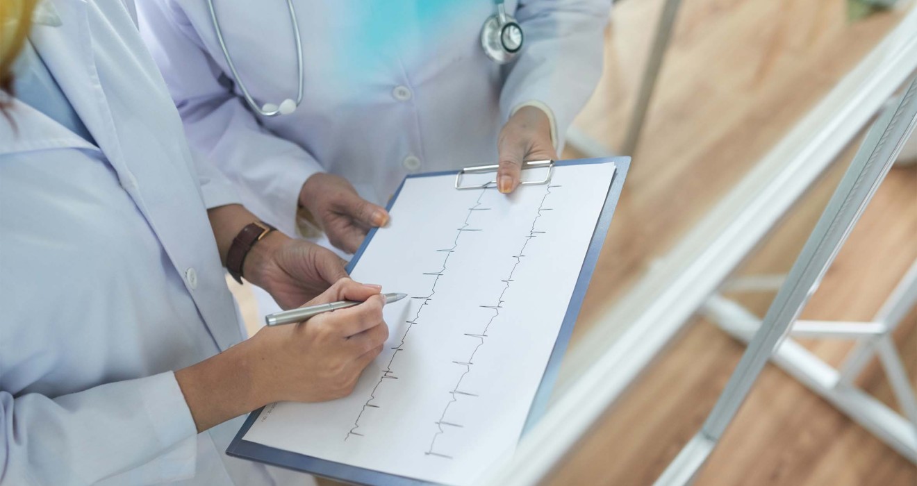 What You Need to Know About Irregular Heartbeats