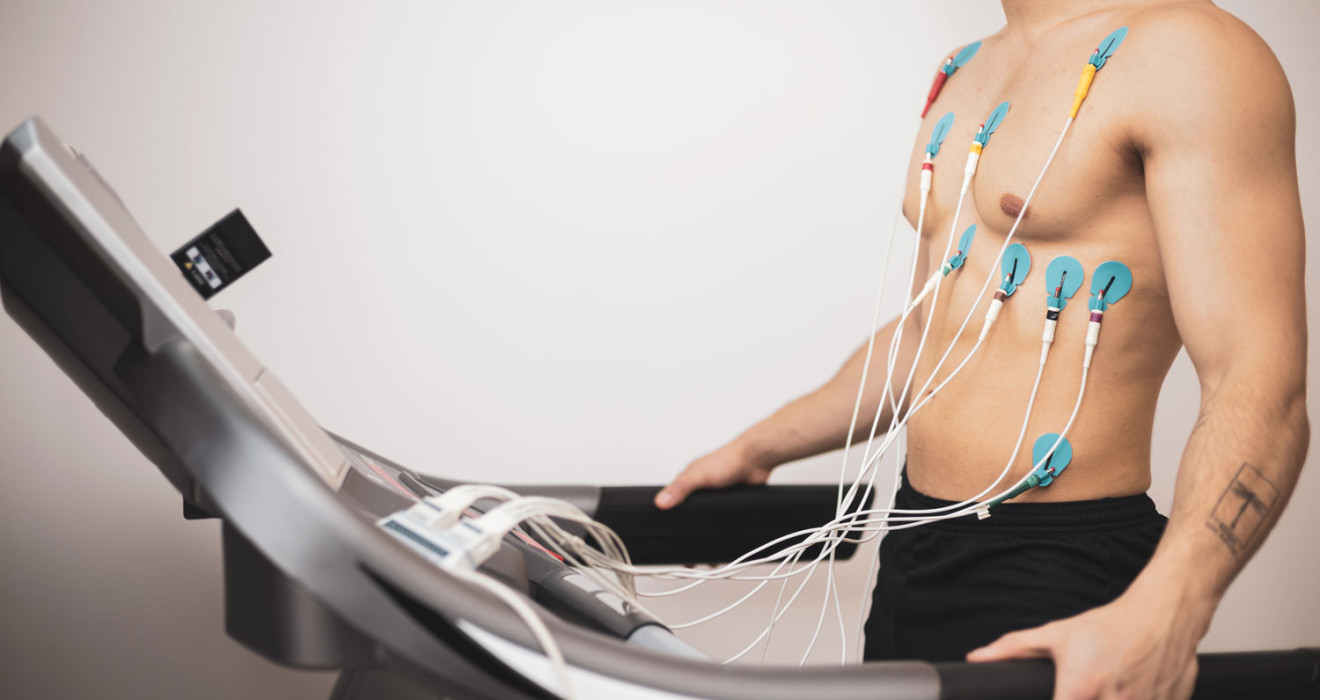 Exercise Test (Stress ECG)