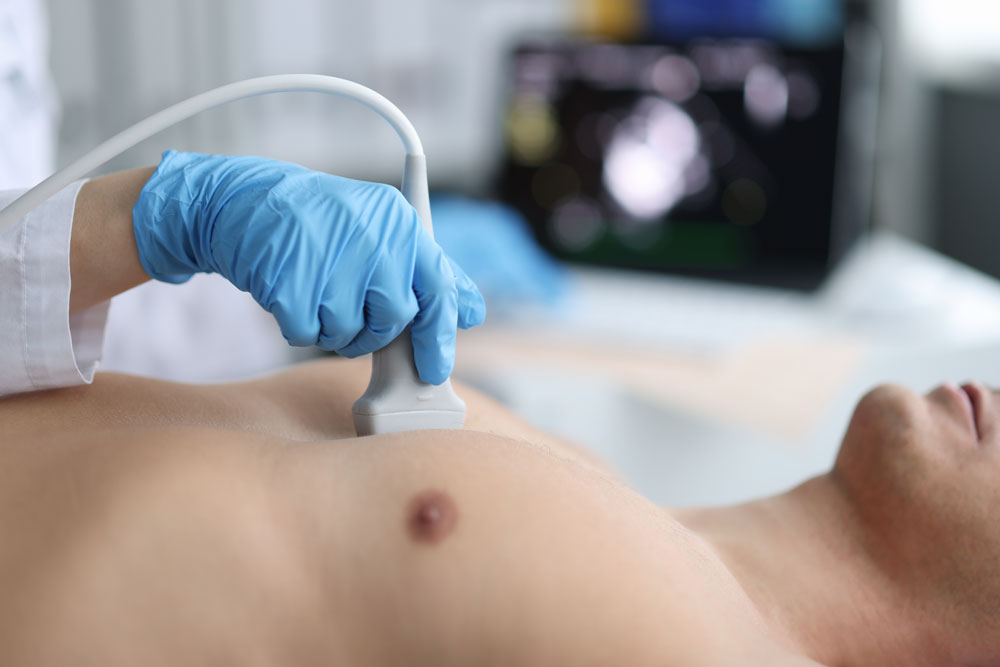 Echocardiography (Cardiac Ultrasound)