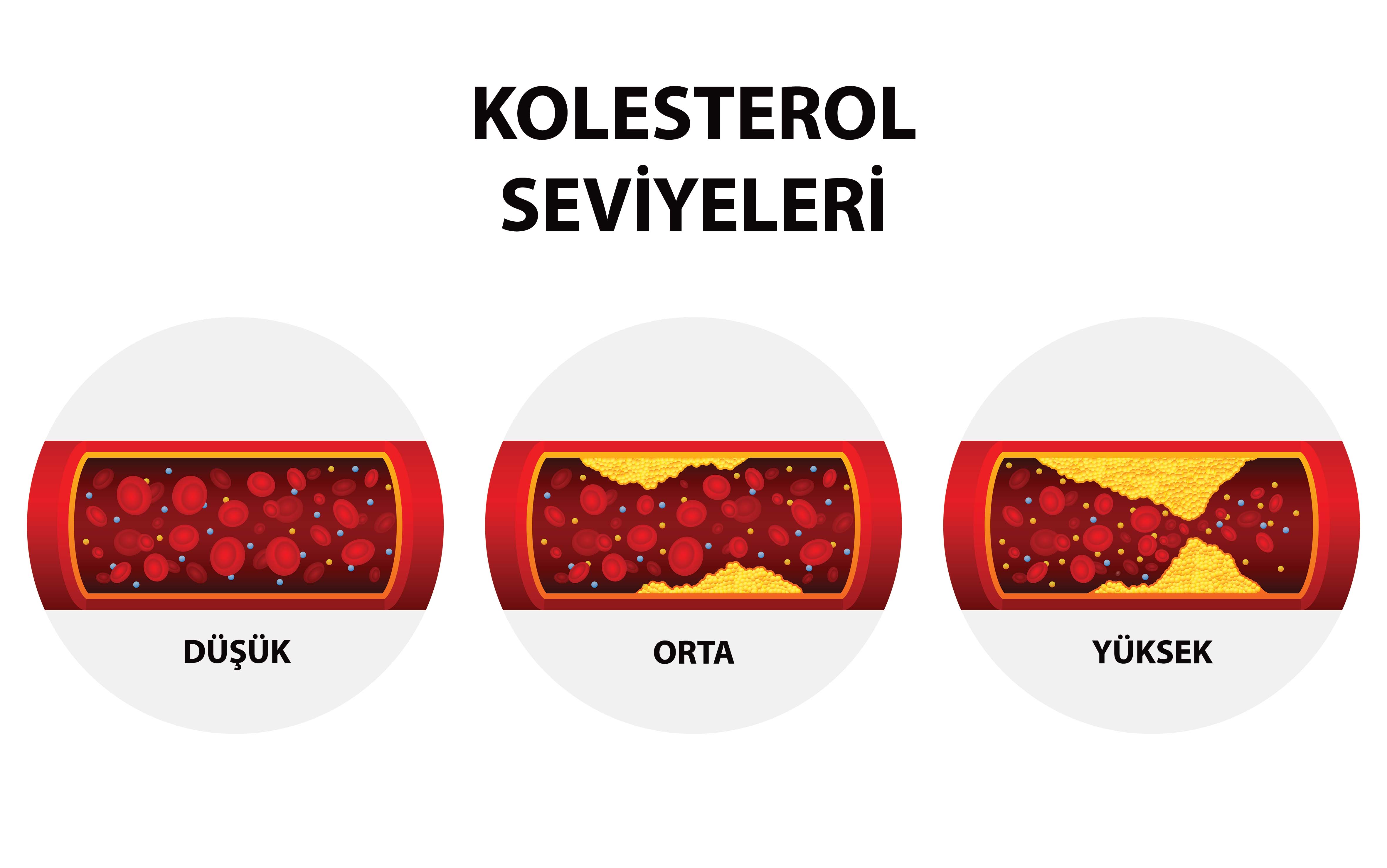 Kalp Kası Kalınlaşması Nedir, Neden Olur?