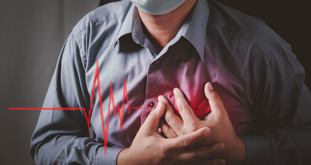 Heart Attack (Myocardial Infarction)