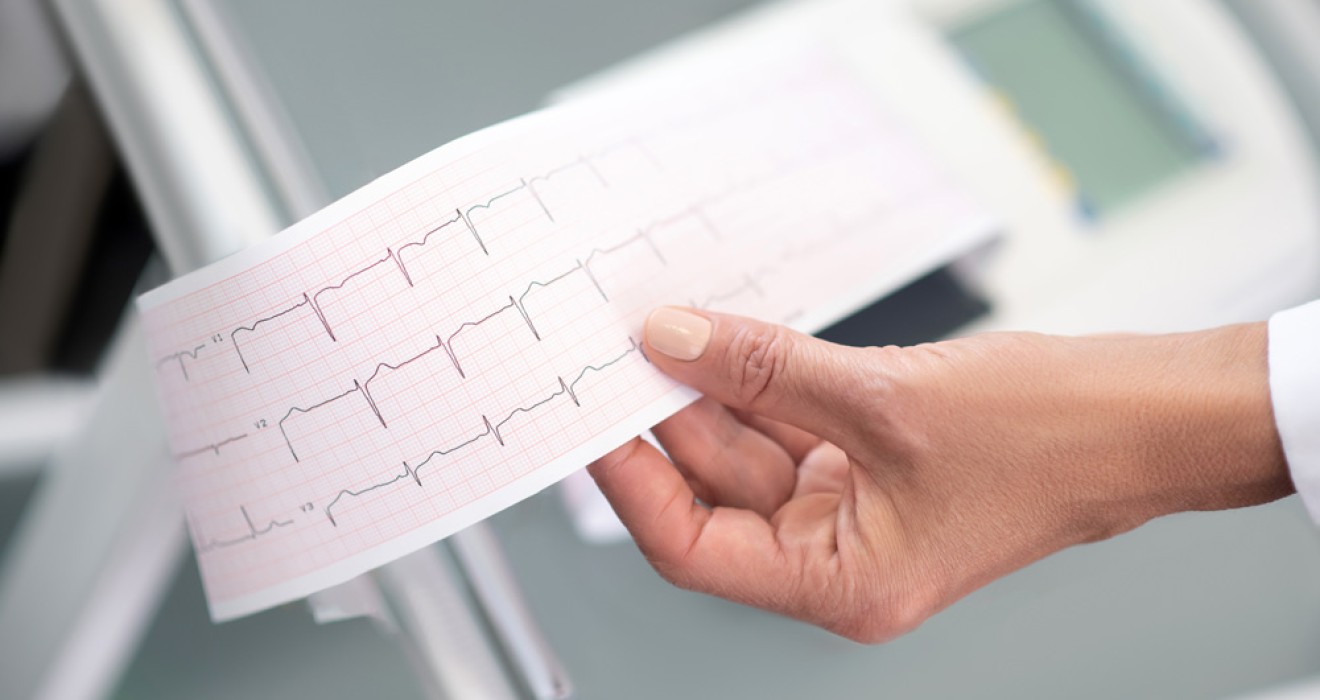 Kalp Rahatsızlıklarının Tanısında EKG'nin Rolü Nedir?