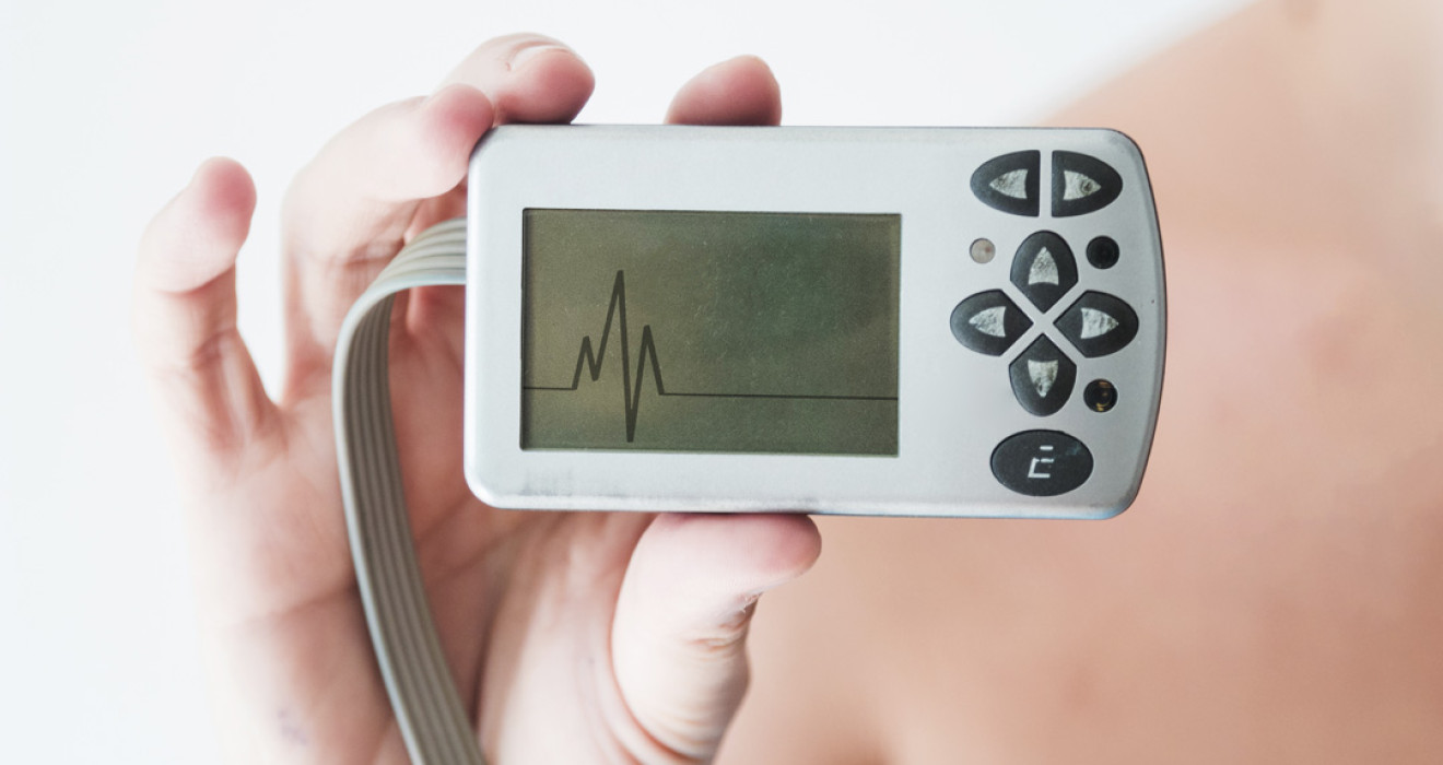 Kalp Ritim Testleri Ne Zaman Gerekir?