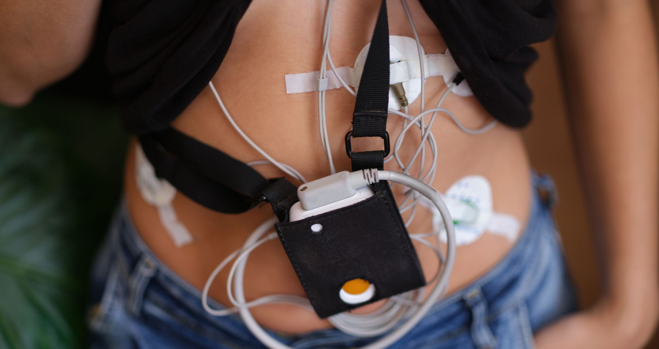 Blood Pressure Holter (Ambulatory Blood Pressure Monitoring)