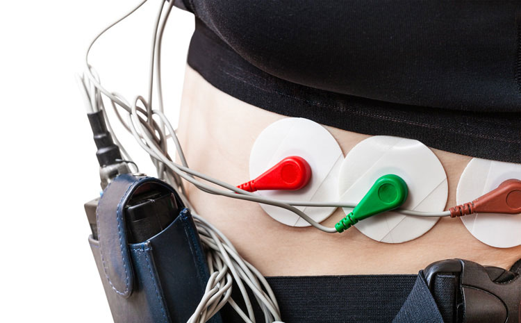 Rhythm Holter ECG