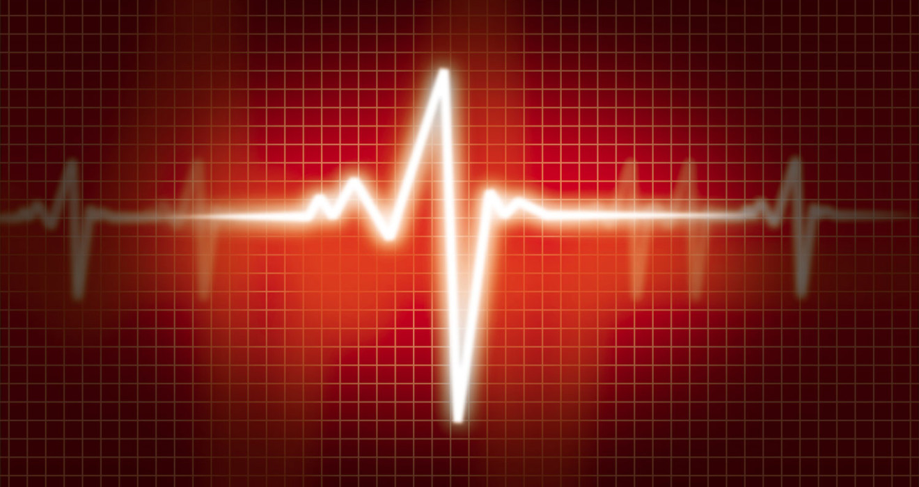 Rhythm Disorder (Arrhythmia) Treatment