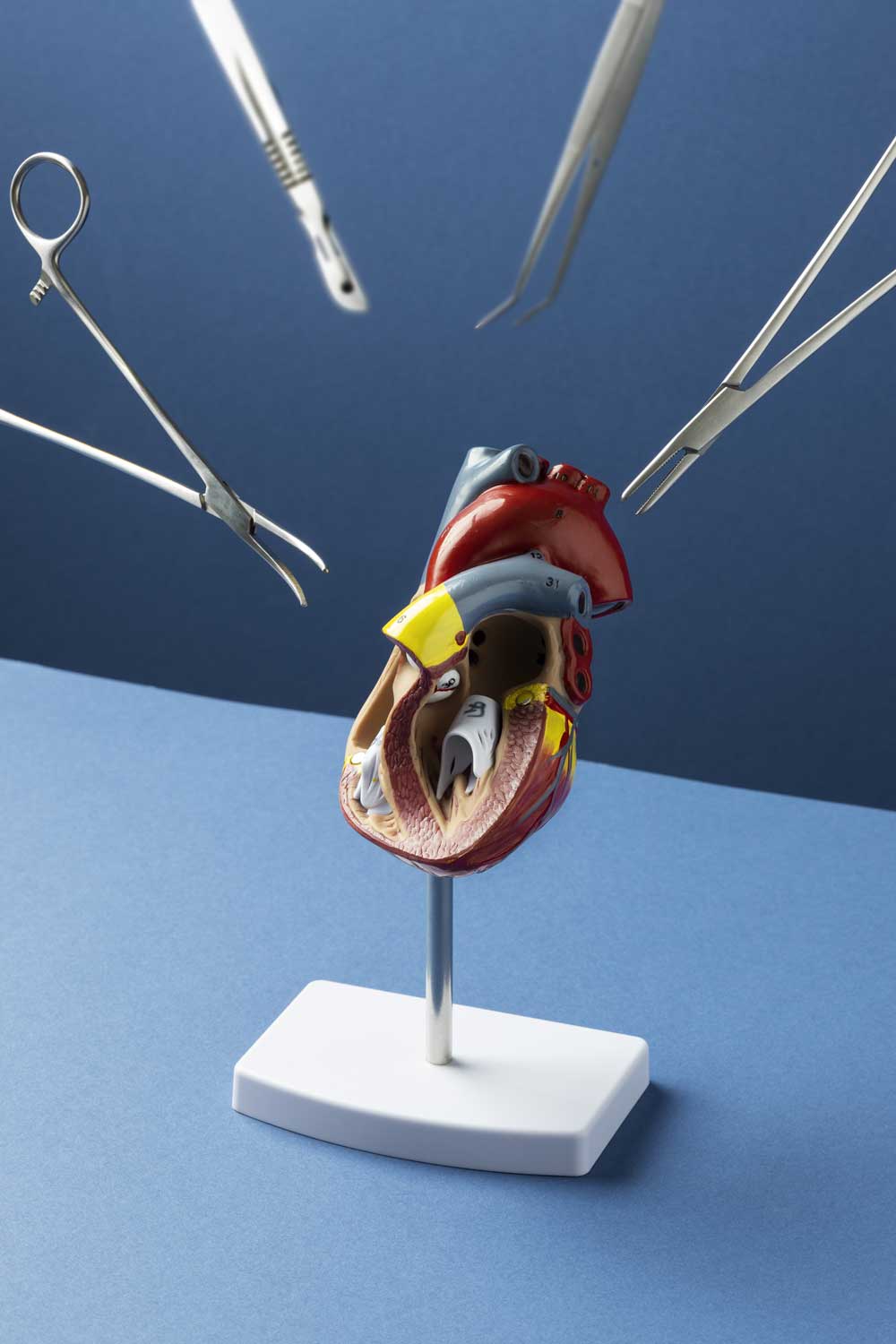 stent nedir, neden takılır