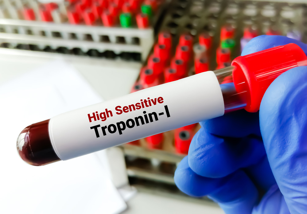 Troponin: Nedir, Yüksekliği Nasıl Düşürülür?