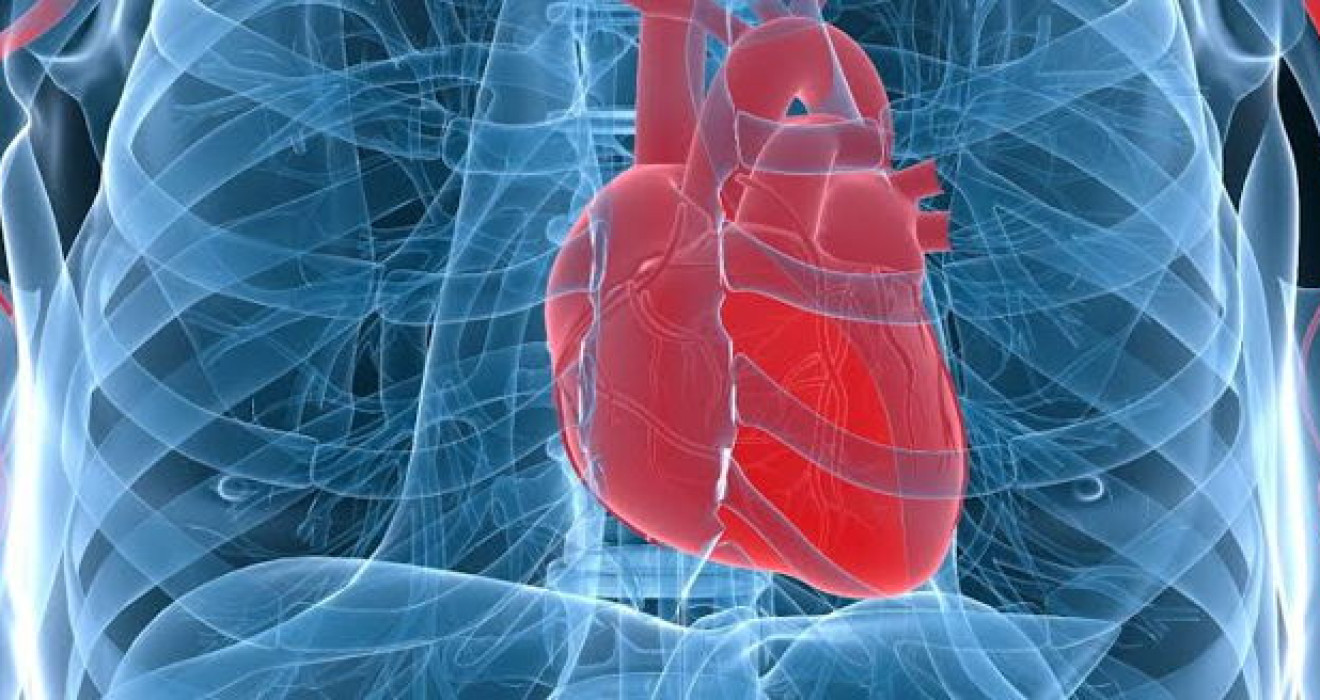 What is Stent?